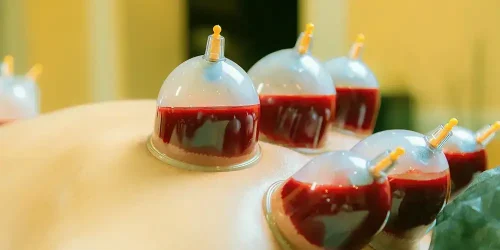 hijama Tanger addiction